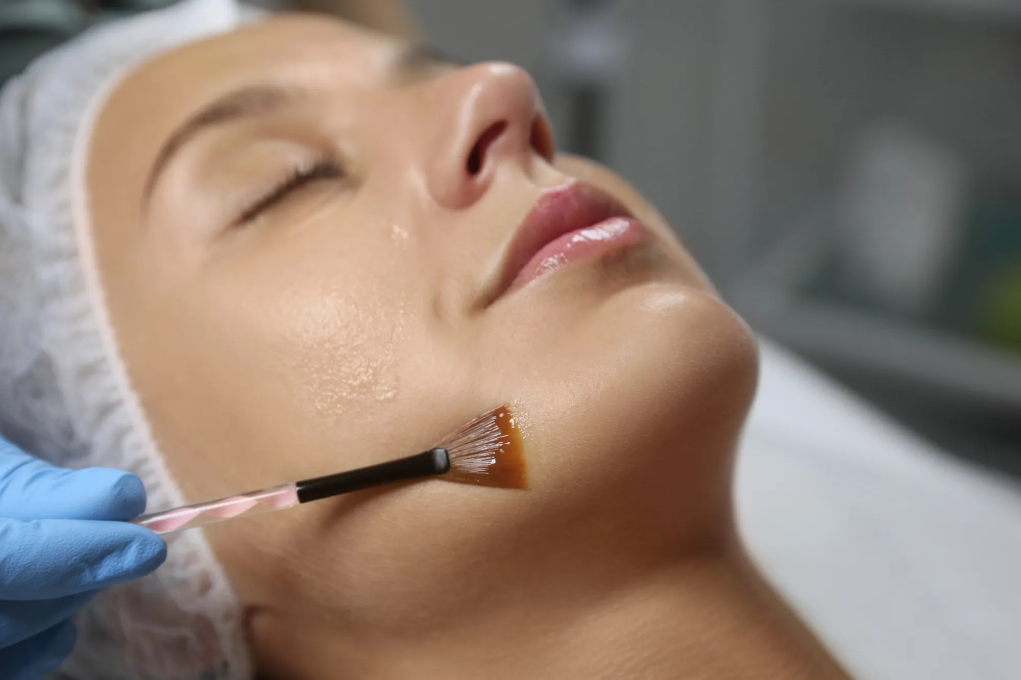 Peeling Biorevitalizzante Senza Downtime a Roma: Il Trattamento che Non Vedi, ma Senti